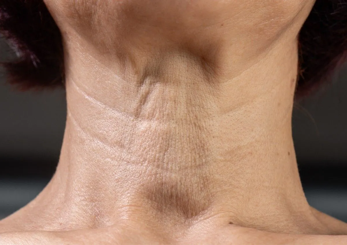 Neck