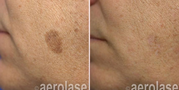 neoskin-b-a-aesthetic-couture-greensboro-nc